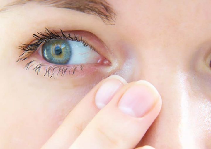 Prévenir la Sécheresse Oculaire : Conseils pour Garder des Yeux en Bonne Santé à l’Ère Numérique